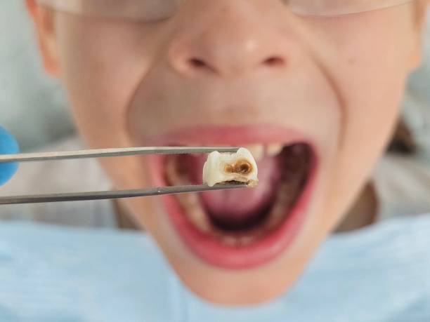 Best Emergency Treatment for Toothache in Fairview Park, OH